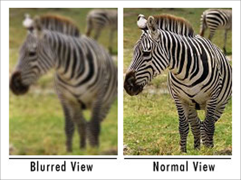Astigmatism