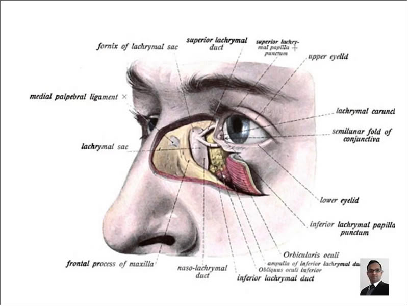 DCR External And Endonasal