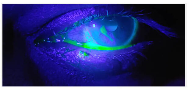 cornea-specialist-near-me